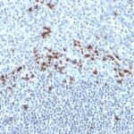 Formalin-fixed, paraffin embedded human tonsil sections stained with 100 ul anti-Kappa Light Chain (clone Kap-56) at 1:50. HIER epitope retrieval prior to staining was performed in 10mM Citrate, pH 6.0.